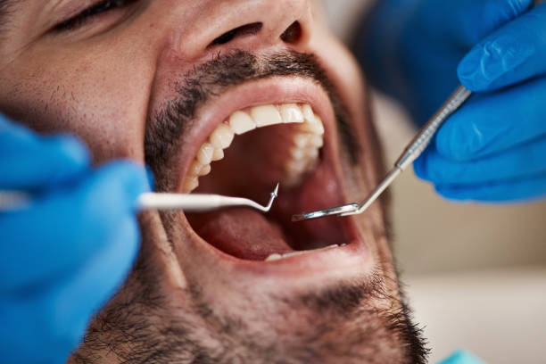 Best Emergency Dental Care for Broken or Chipped Teeth in Flippin, AR